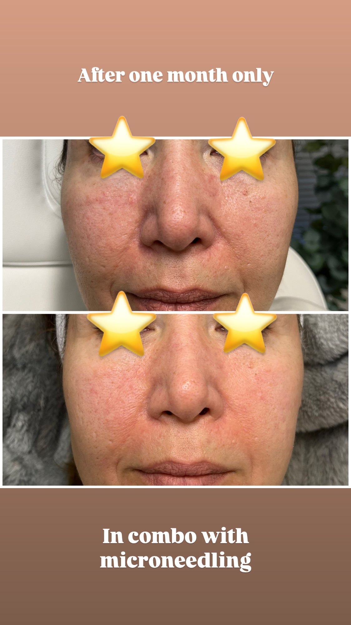 Biojuve Probiotic Skincare (with Cleanser)