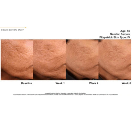 Biojuve Probiotic Skincare (with Cleanser)