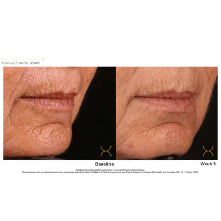 Biojuve Probiotic Skincare (with Cleanser)