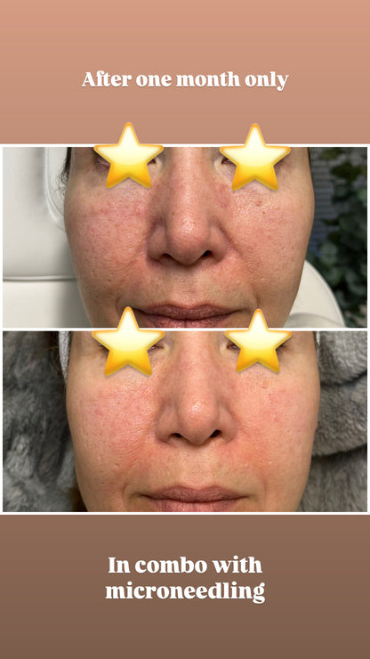 Biojuve Probiotic Skincare (with Cleanser)