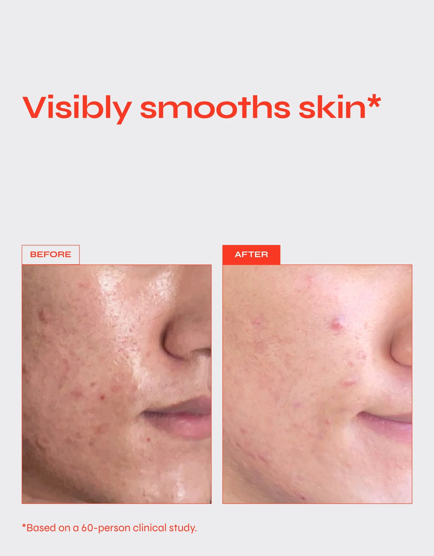Facile REVERSE Anti-Aging Serum for Fine Lines