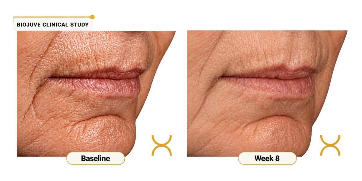 Probiotic Skincare