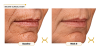 Probiotic Skincare