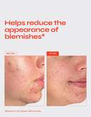 CLEAR Exfoliating Serum