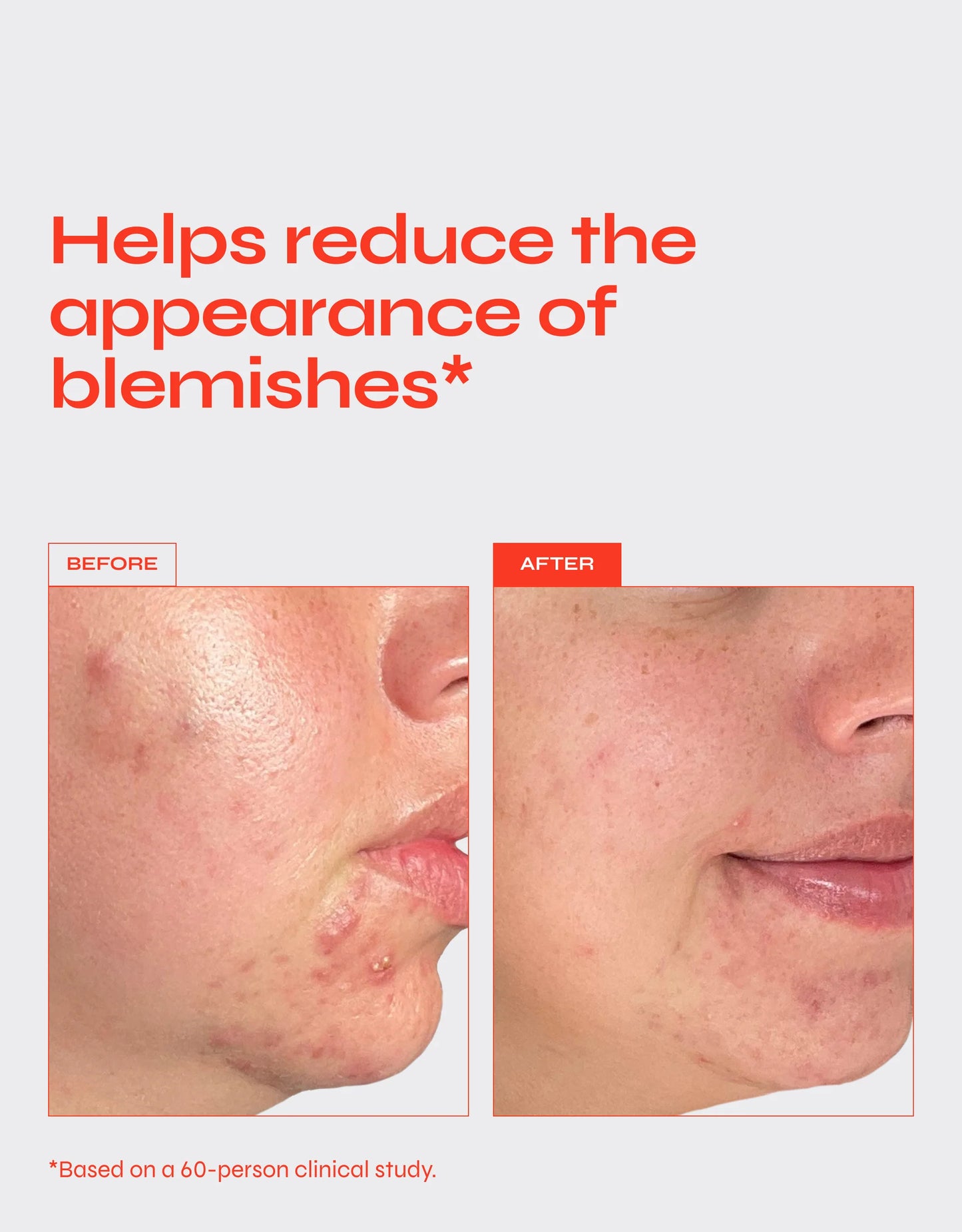 Facile CLEAR Exfoliating Serum