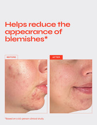 CLEAR Exfoliating Serum