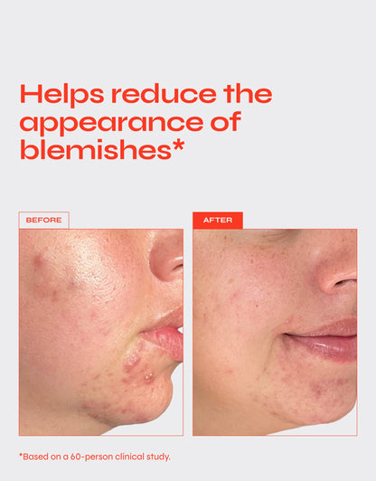 Facile CLEAR Exfoliating Serum