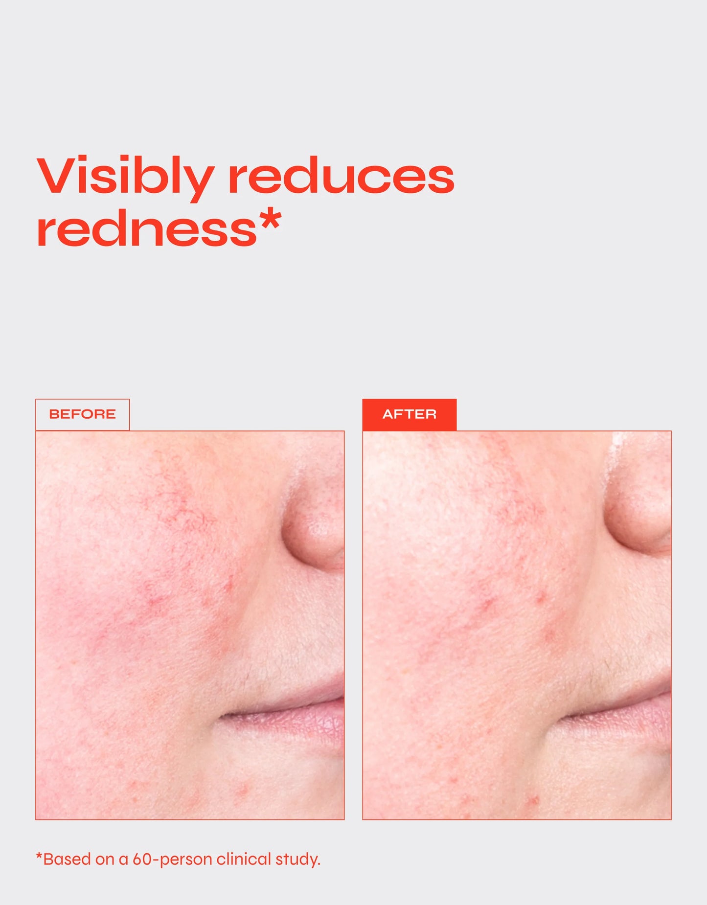 Facile DESTRESS Redness Calming Serum