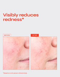 DESTRESS Redness Calming Serum